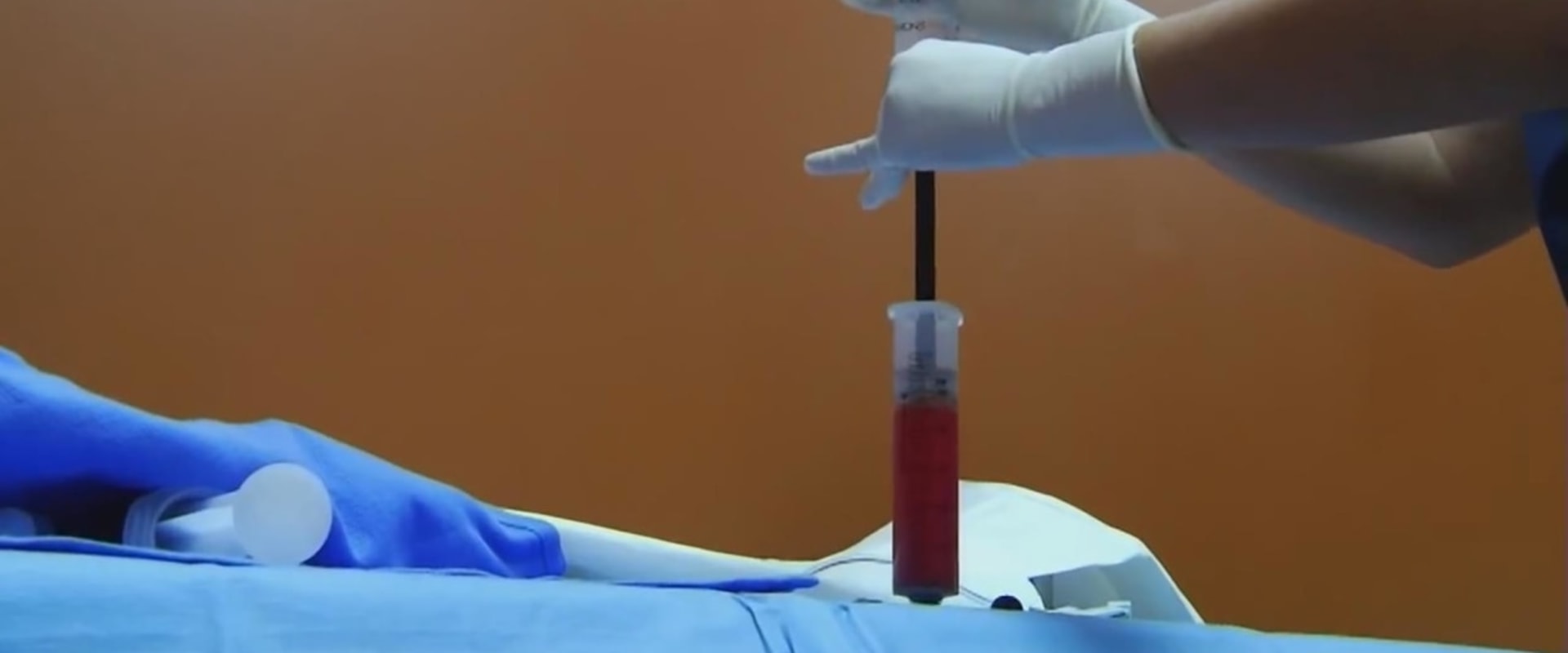 Why Medical Professional Networking Matters For Stem Cell Transplantation Success In Lake Worth, FL