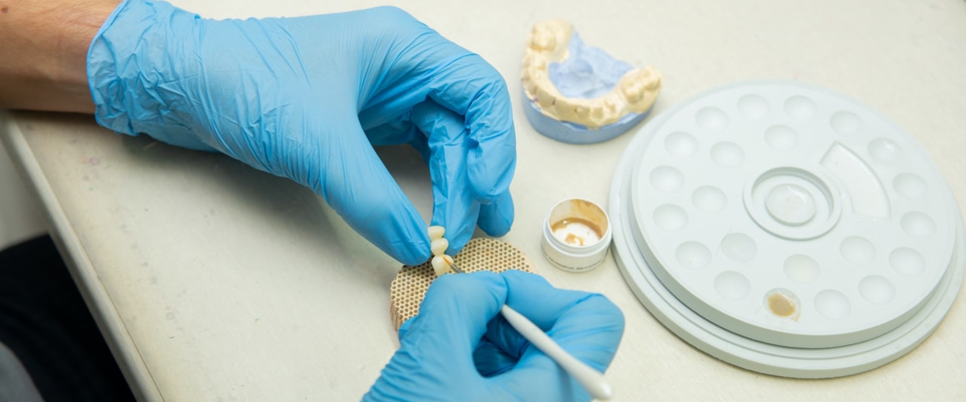 Unlocking Success: How Medical Professional Networking Can Enhance Your Implant Teeth Journey In London