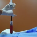 Why Medical Professional Networking Matters For Stem Cell Transplantation Success In Lake Worth, FL