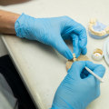 Unlocking Success: How Medical Professional Networking Can Enhance Your Implant Teeth Journey In London