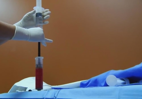 Why Medical Professional Networking Matters For Stem Cell Transplantation Success In Lake Worth, FL