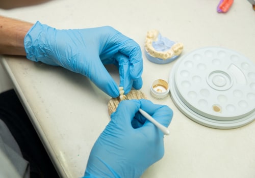 Unlocking Success: How Medical Professional Networking Can Enhance Your Implant Teeth Journey In London